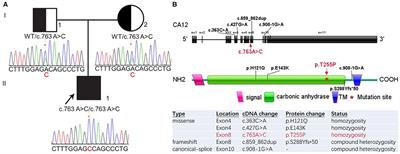 Case Report: Novel CA12 Homozygous Variant Causing Isolated Hyperchloridrosis in a Chinese Child With Hyponatremia